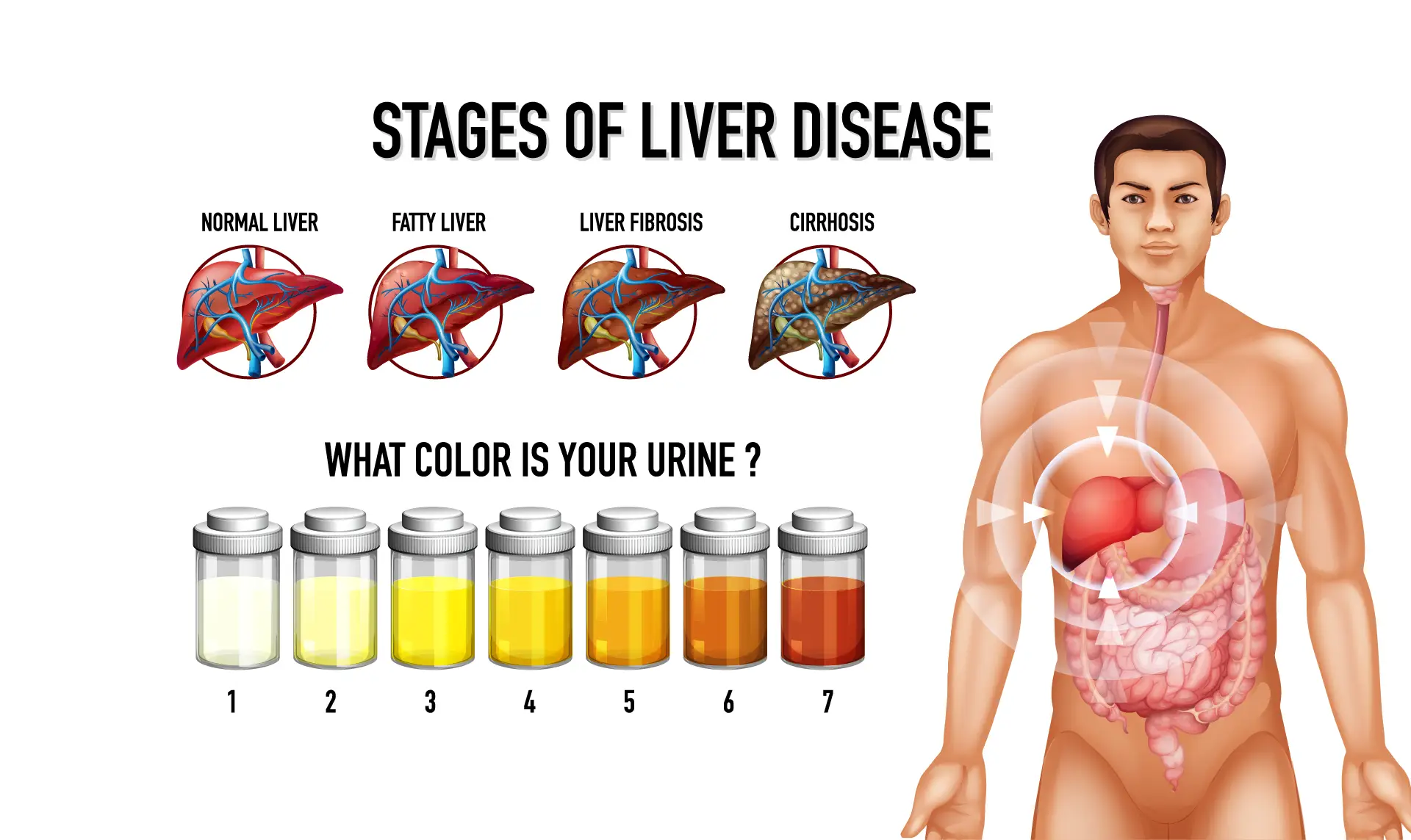 Liver Disease Causes, Symptoms & Prevention